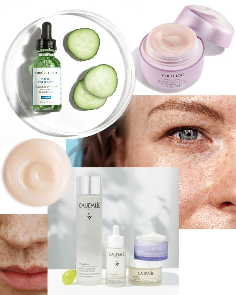 Melasma