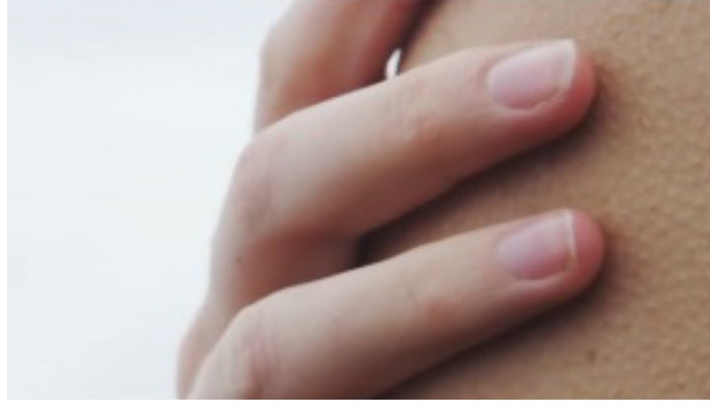 DESARROLLADO POR DERMATÓLOGOS