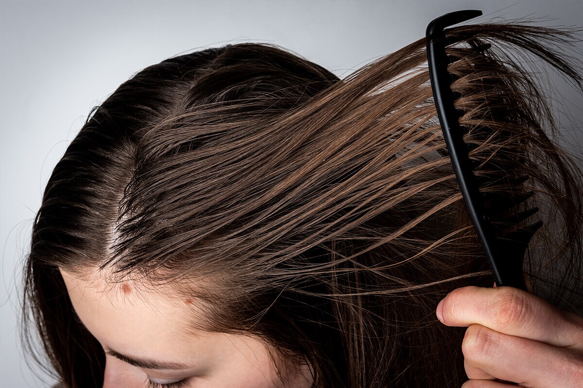 Cabello graso