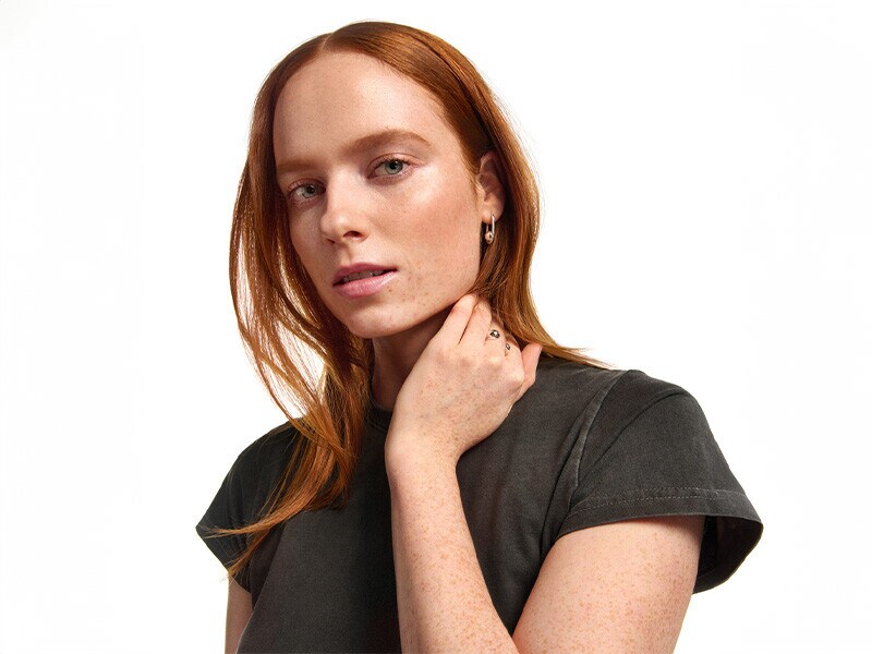 Acne na idade adulta